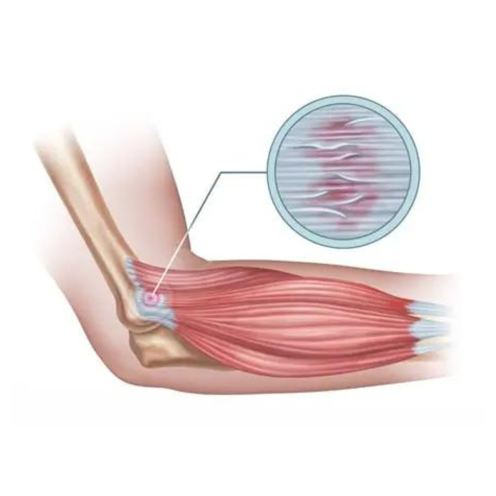 Har du ondt i dine led – “uden grund”?